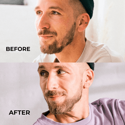 Avoura Men – Hair Growth Oil for Scalp & Beard