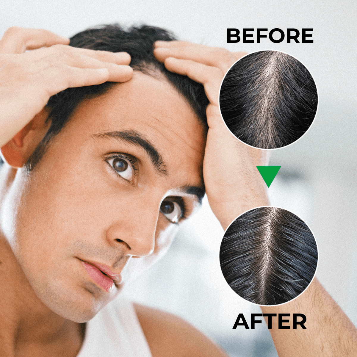 Avoura Men – Hair Growth Oil for Scalp & Beard